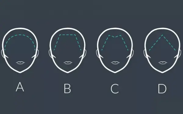 Your Hairline Reveals Your Personality and Preferences
